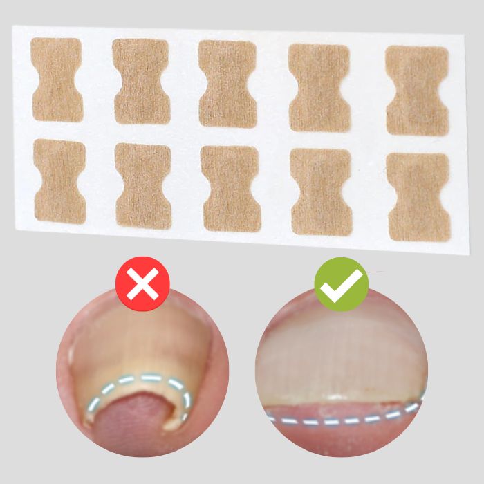 FinePatches™ | Correction Patches for Beautiful and Healthy Nails