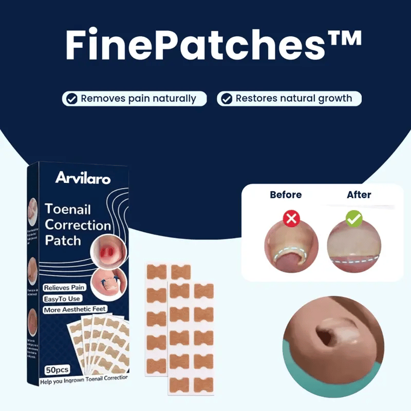 FinePatches™ | Correction Patches for Beautiful and Healthy Nails