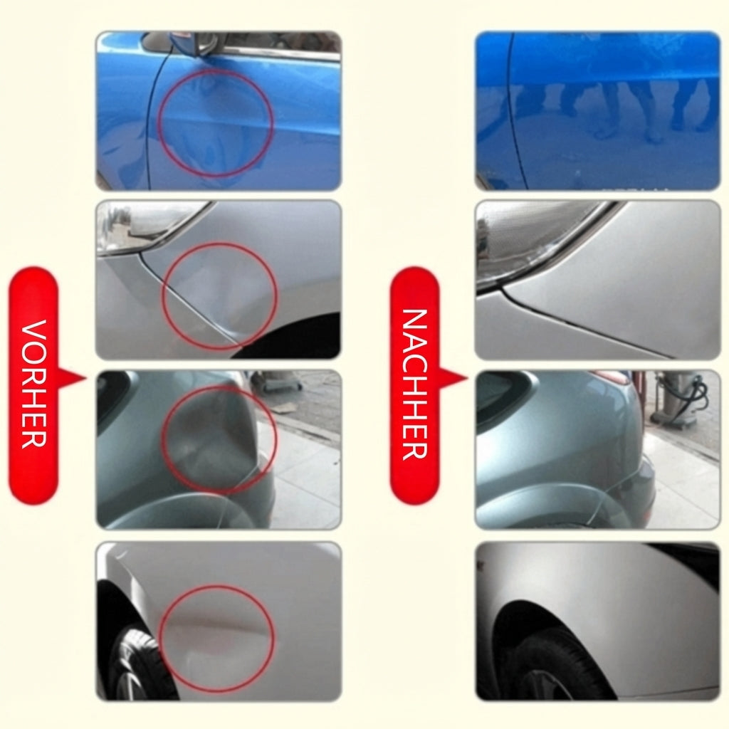Dent Remover – Fix Dents Without Visiting a Workshop