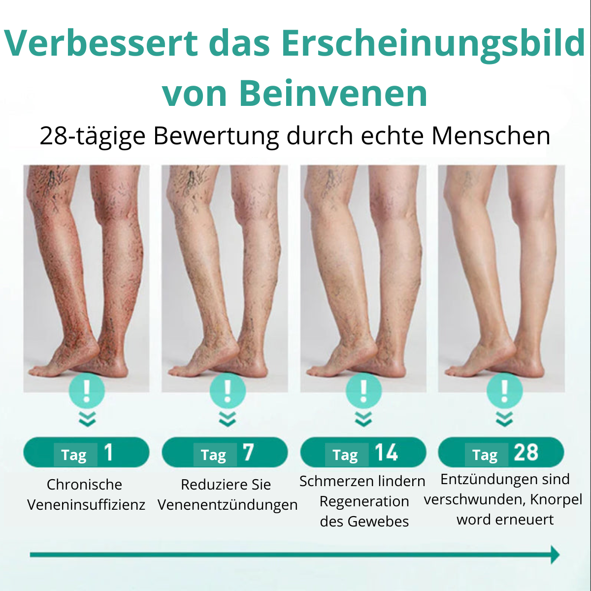 VenoLift Patches – Relief for Painful, Visible Veins