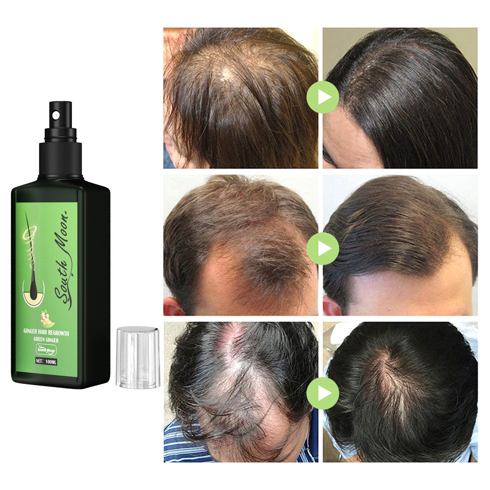GrowthPlus Nourishing Ginger Spray
