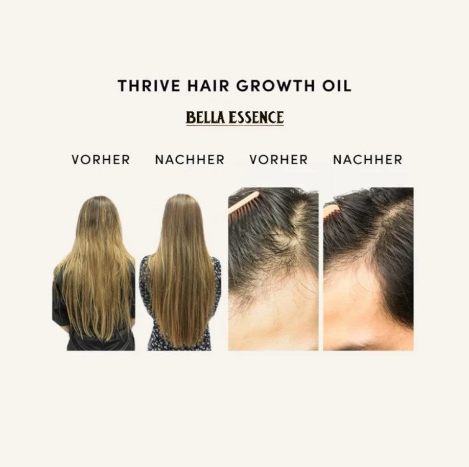 BellaGuard™ — Stop Hair Loss, Boost Thickness | 1+1 Free