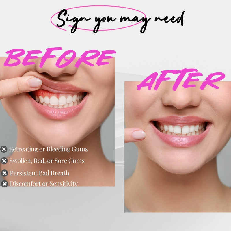 Gentle Gum Care Device with Red and Blue Light Therapy