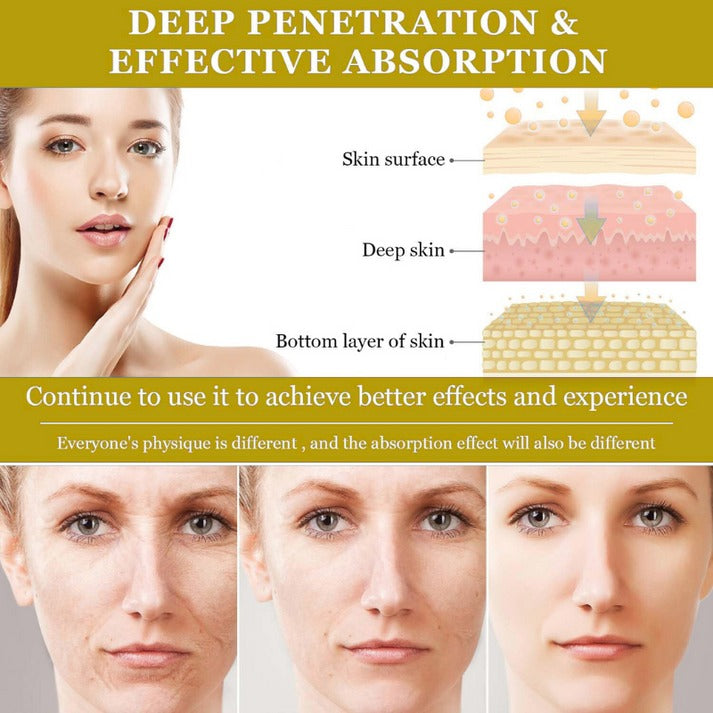 VLyft™ | Sculpt your V-line in minutes, no surgery needed!