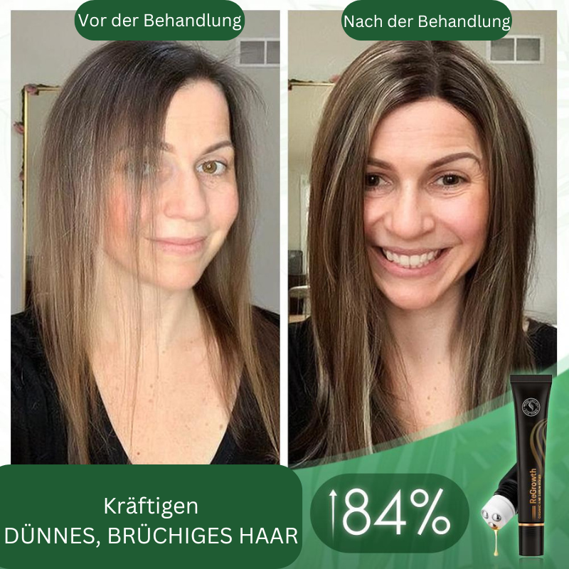 RamiraFortis™ — Ignite Your Scalp to Reveal Fuller, Thicker Hair That Commands Attention