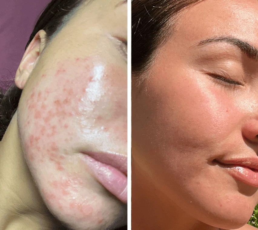 Transform Dull Skin into Radiant Freshness and Gentle Relaxation