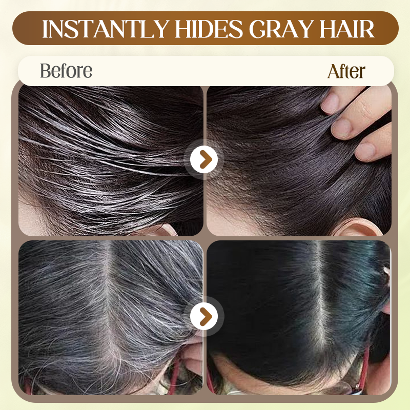 Instantly Look Youthful with Gray Hair Disappearing Solution