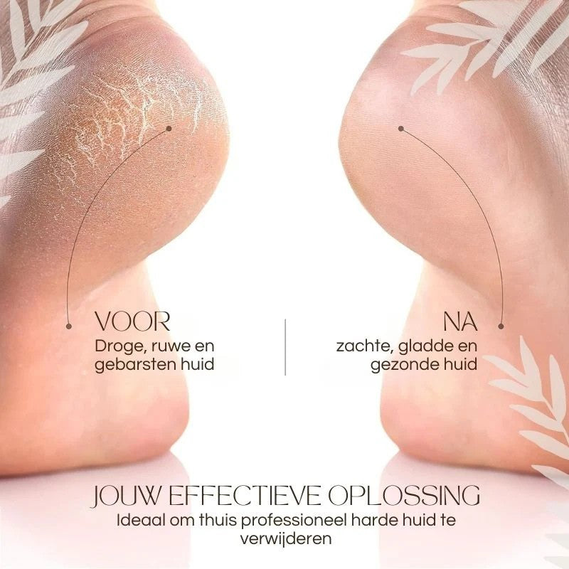 SilkStride™ — Effortless Soft Feet That Boost Your Confidence Instantly