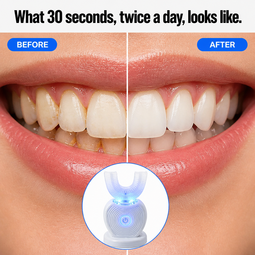 SonicBeam™ Complete — Brush Every Tooth at Once in 30 Hands-Free Seconds