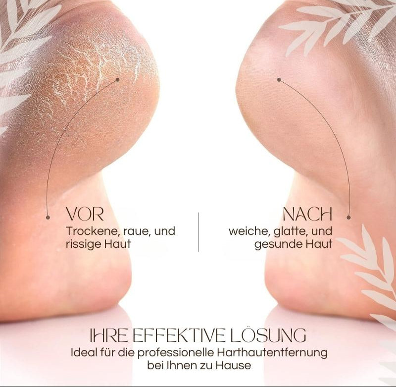 SoleRadiance™ — Unlock Baby-Soft Feet You’ll Proudly Show Off Every Day