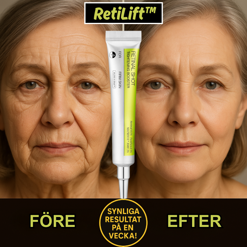 LumaRise™ — Rediscover Radiant, Youthful Eyes That Boost Your Confidence Every Day