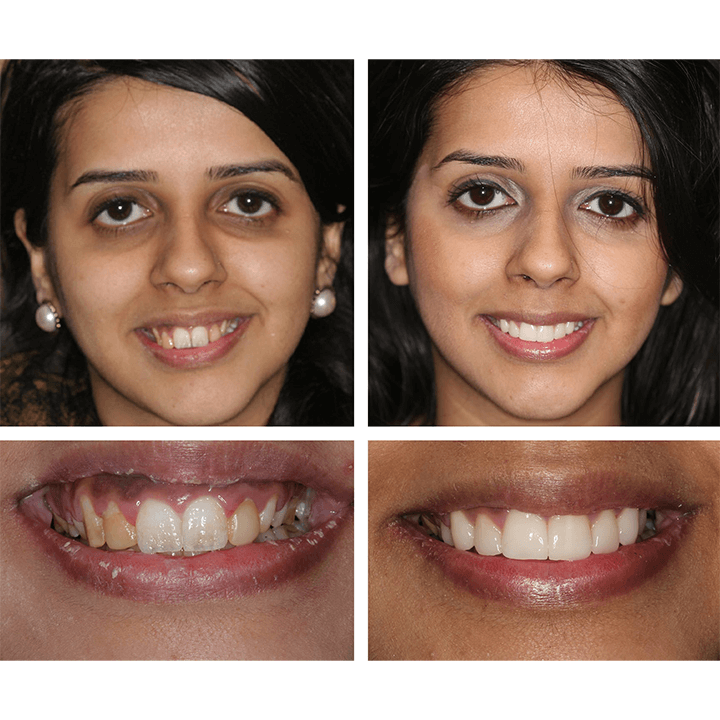 RadiantPearl™ Whitening Essence — Brighten Your Smile with Gentle, Head-Turning Confidence