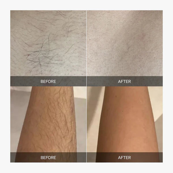 LumaSilk™ — Pain-Free, All-Over Smoothness That Fuels Your Confidence