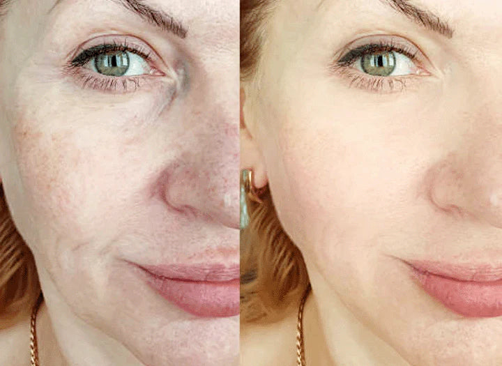 LumiDerma™ — Erase Dark Spots and Unleash Your Radiant Glow