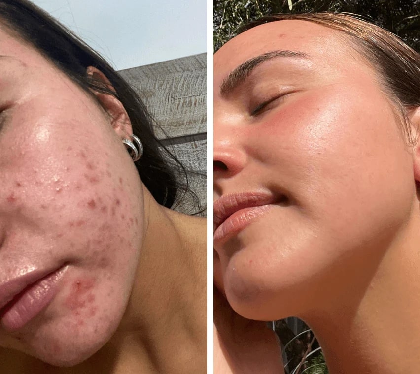 Transform Dull Skin into Radiant Freshness and Gentle Relaxation