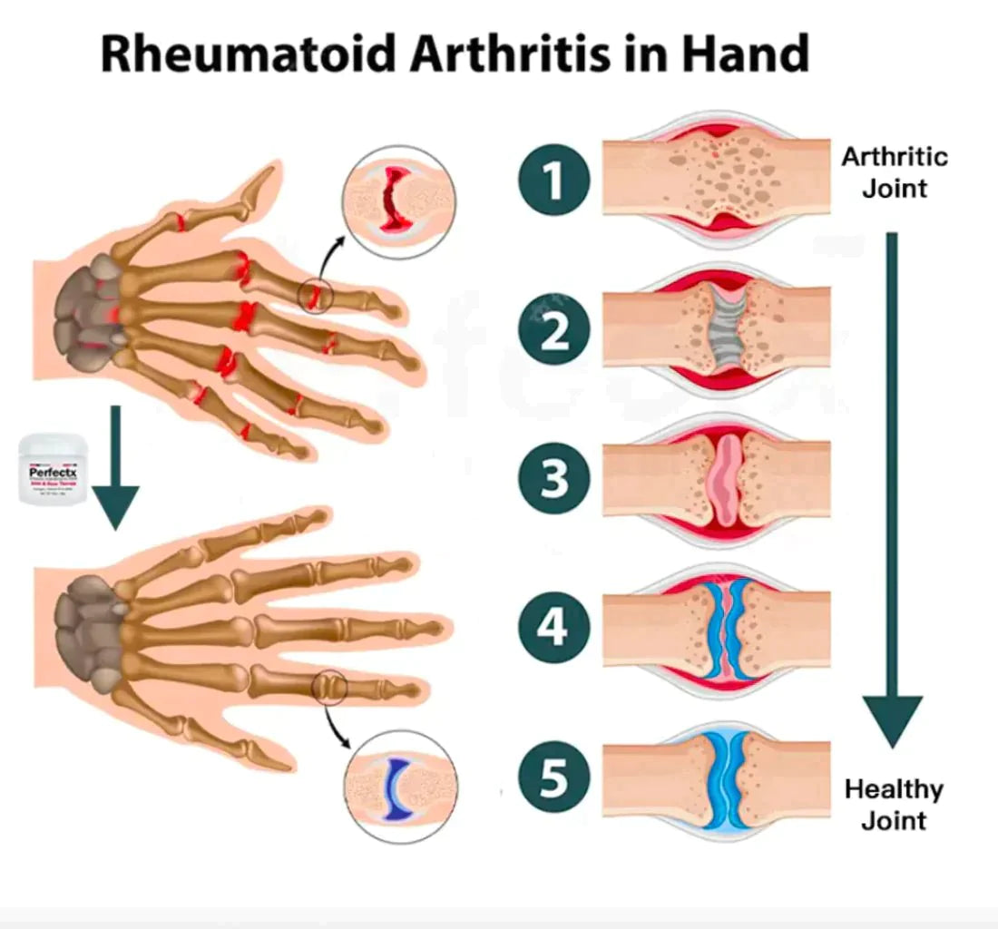 ArthriEase™ — Unlock Effortless Movement and Wave Goodbye to Pain Fast