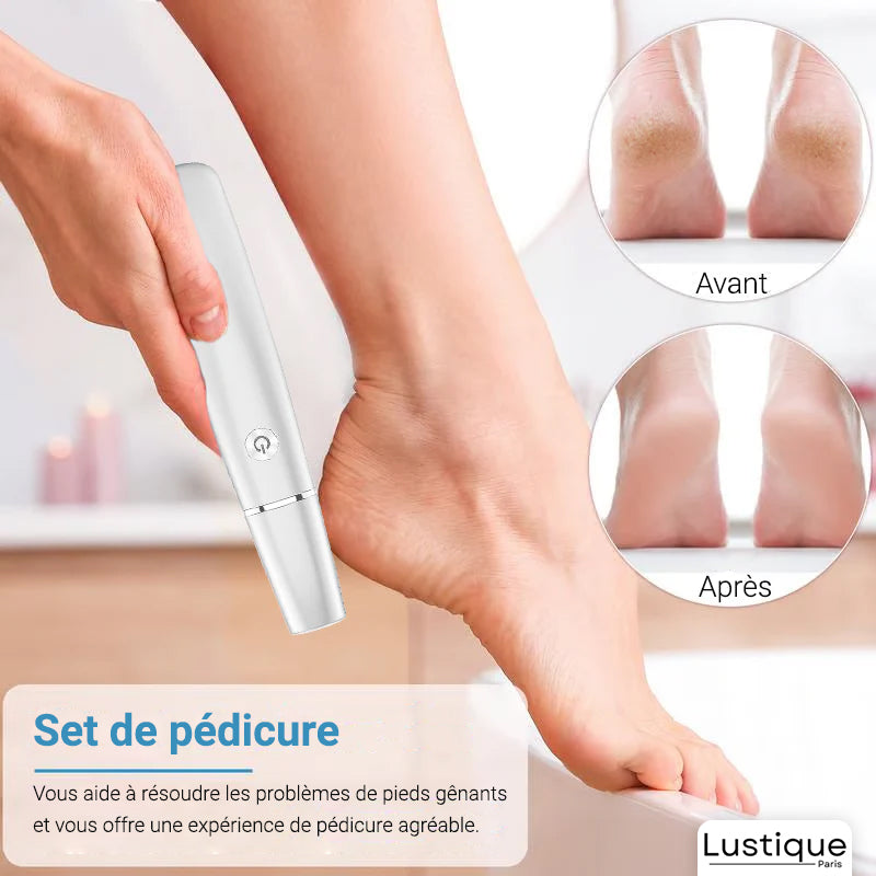 SilkStep™ Electric Callus Remover — Effortless Soft Feet You’ll Love Showing Off