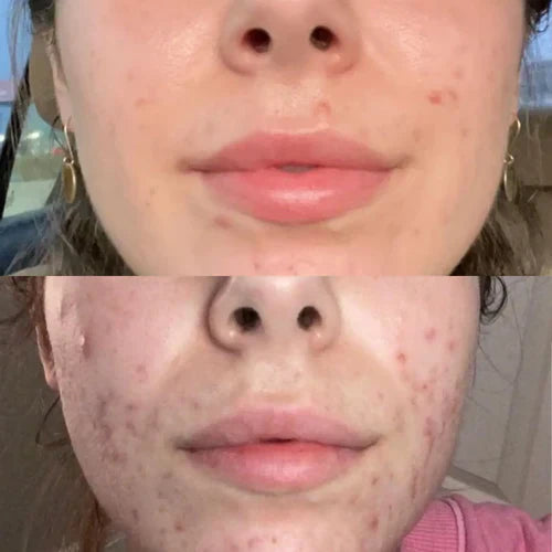 RadianceWave™ — Unlock Radiant, Youthful Skin That Turns Heads Every Time