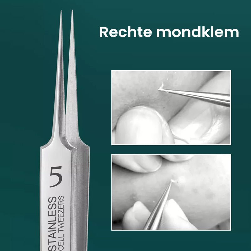 GlideSkin™ — Unleash Your Glow with Painless, Precision Blackhead Removal