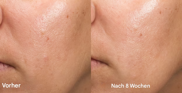 LumaPure™ — Unleash Your Glow with Calming, Spot-Fading Softness