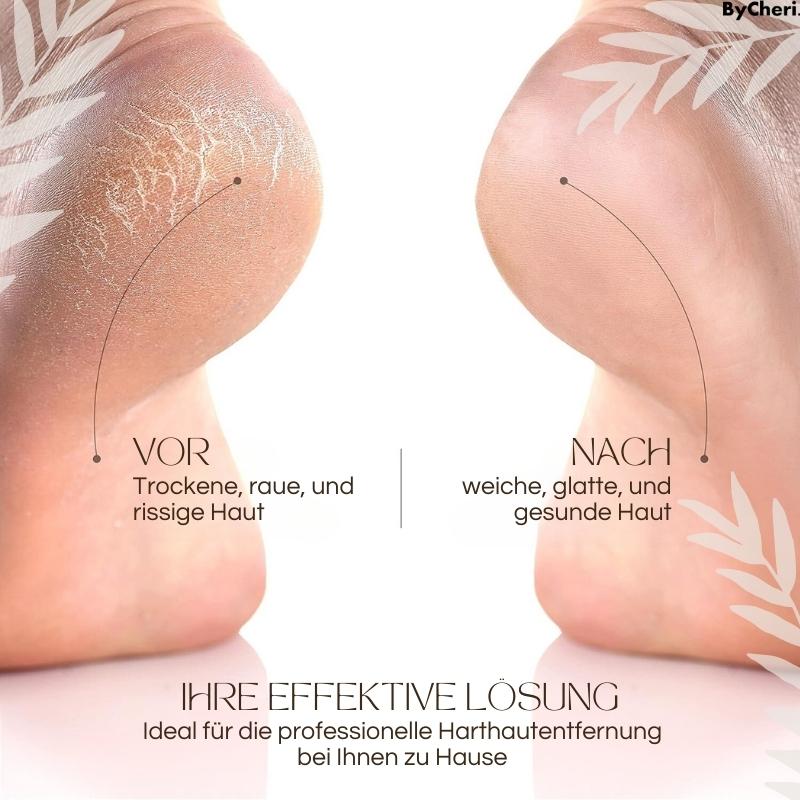 SmoothStride™ — Effortless Soft Feet That Boost Your Confidence Every Step