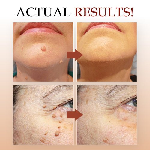 DermaVanish™ — Effortless, Pain-Free Skin Renewal That Restores Your Confidence Fast