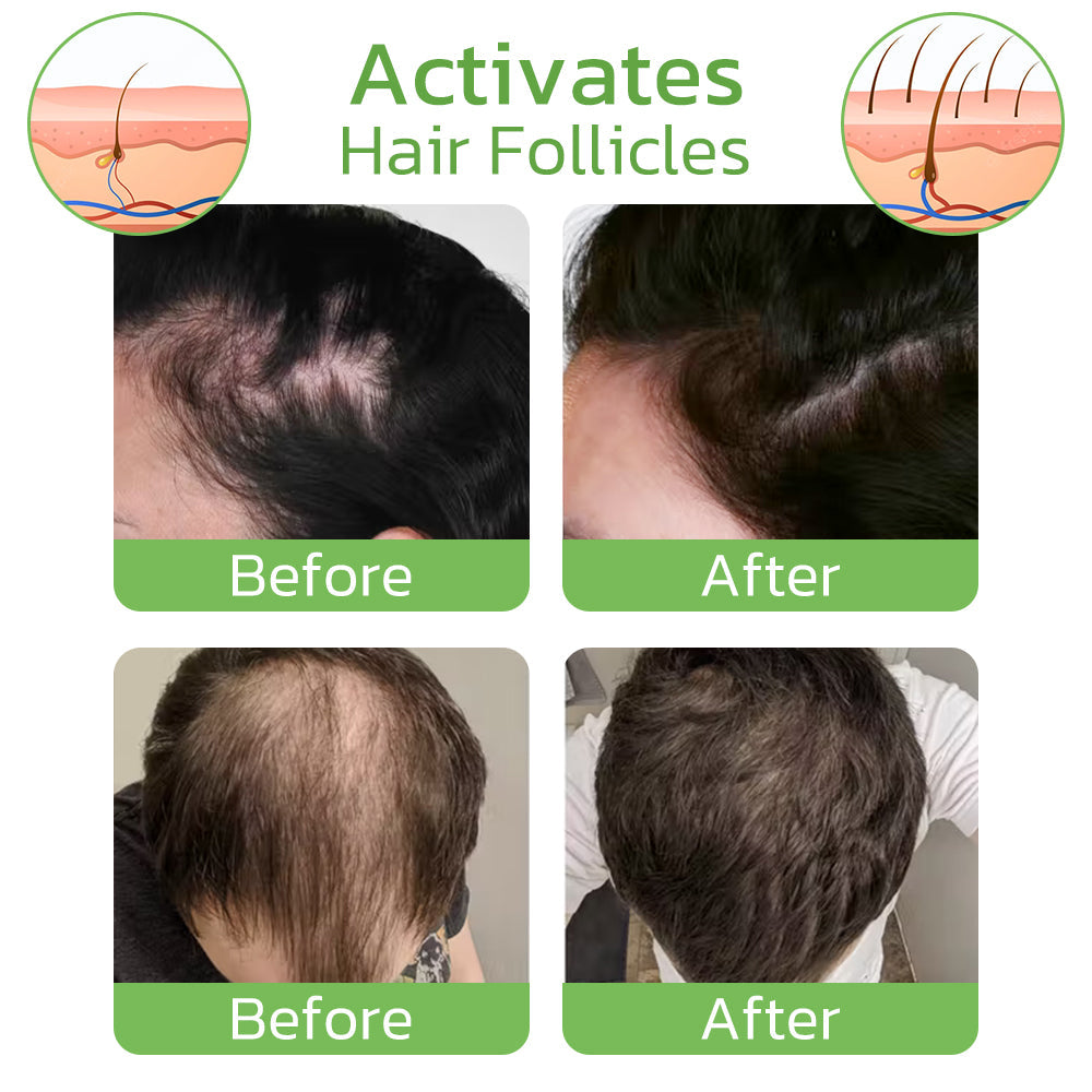 VitaRoot™ Revitalizing Ginger Spray — Reawaken Your Hair, Reclaim Your Confidence Fast