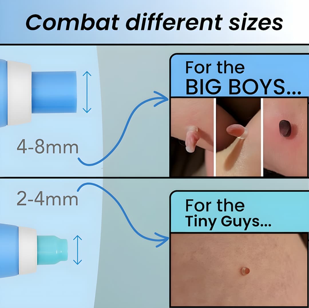 DermaLift™ — Experience Painless Skin Tag Freedom and Radiate Confidence Quickly
