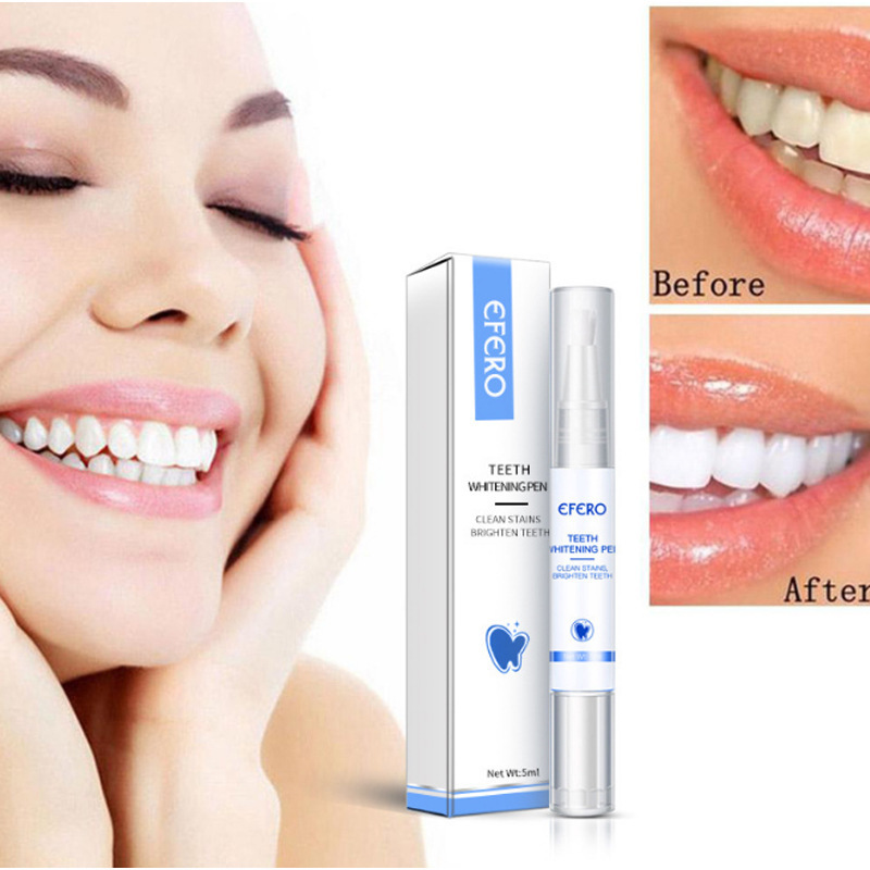 RadiancePro™ Teeth Whitener — Instantly Brighten Your Smile Without Sensitivity