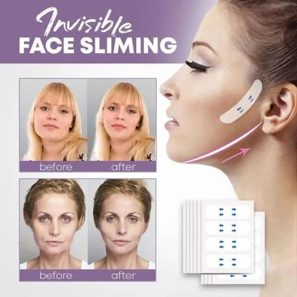 Invisible Face-Lift Kit (40 pieces)