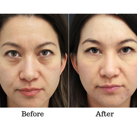 RambleaLift™ — Instantly Restore Youthful, Radiant Eyes That Stop Time