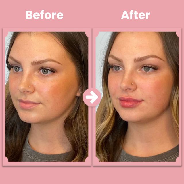 LipTide™ Beauty Roller — Unlock Soft, Plump Lips That Command Every Room