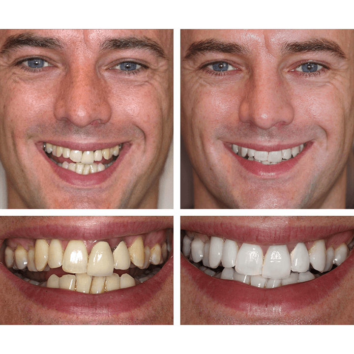 RadiantPearl™ Whitening Essence — Brighten Your Smile with Gentle, Head-Turning Confidence