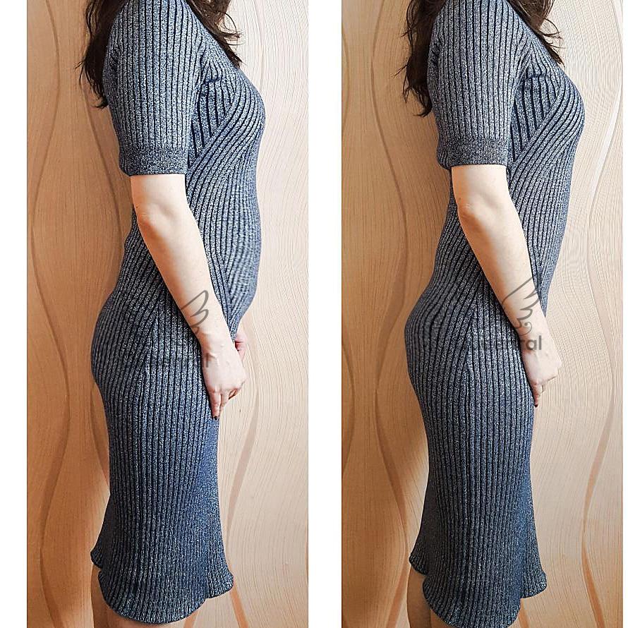 MyDesire | Body Contouring