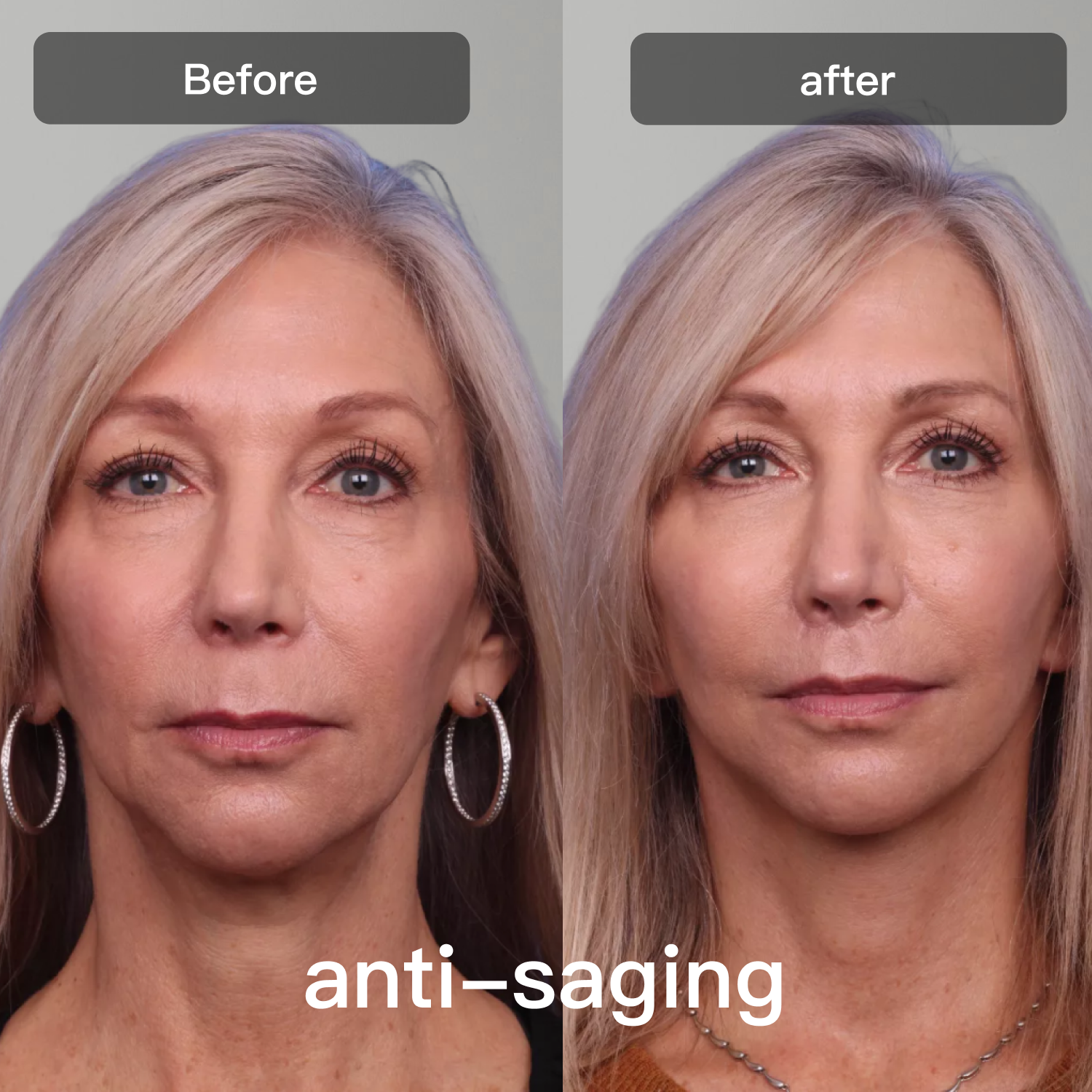 Light Therapy Device for Skin Care on Face and Body