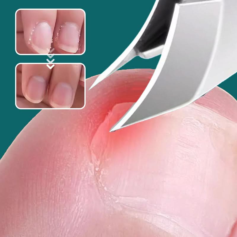 Nail Care Solution – Tidy Nails Without the Mess